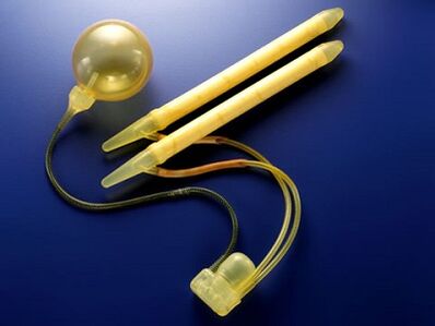 penile prostheses